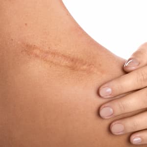 Cosmetic injury Scar Legal Support